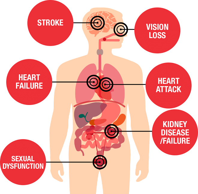 Causes and Effect of Sudden Hypertension