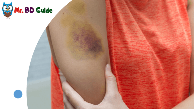 Create a Bruise on Your Hand Like Holywood Movie with Makeup Image - Mr. BD Guide