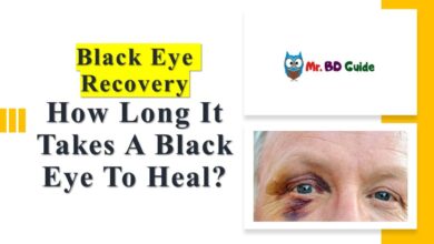 How Long Does A Black Eye Last - Black Eye Recovery - Featured Image