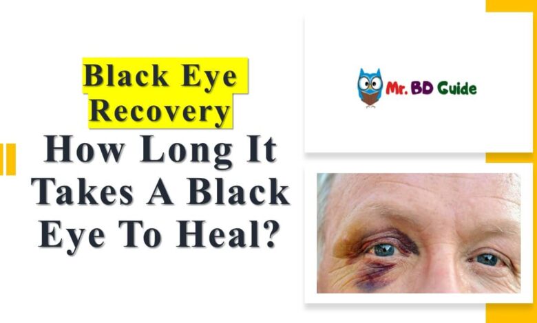 How Long Does A Black Eye Last - Black Eye Recovery - Featured Image