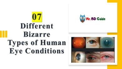 07 Different Bizarre Types of Human Eye Conditions Featured Image