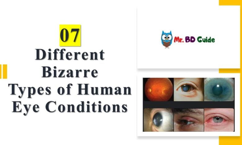 07 Different Bizarre Types of Human Eye Conditions Featured Image