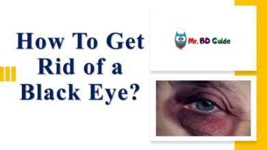 How To Get Rid of a Black Eye Featured Image