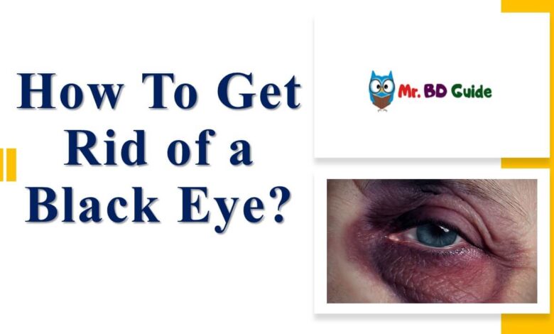 How To Get Rid of a Black Eye Featured Image