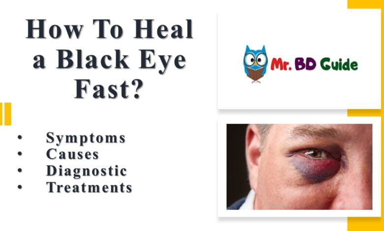 How To Heal a Black Eye Fast Featured Image - Mr. BD Guide