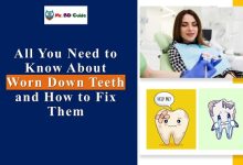 How To Fix Worn Down Teeth Featured Image - Mr. BD Guide