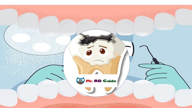 How To Fix Worn Down Teeth Post Image - Mr. BD Guide