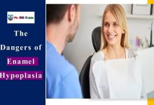 10 Dangers of Enamel Hypoplasia 27 10 Dangers of Enamel Hypoplasia Featured Image - Mr. BD Guide